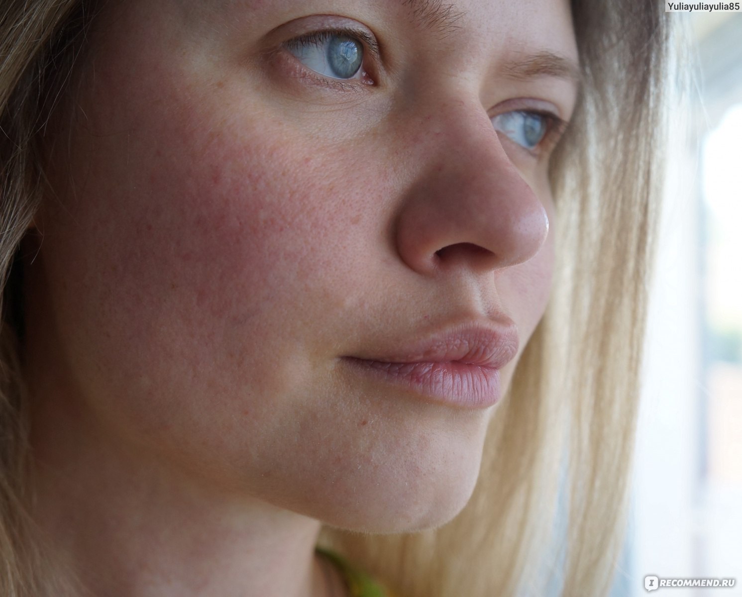 ALISCA Schneckenschleim Gesichtspflege-до использования