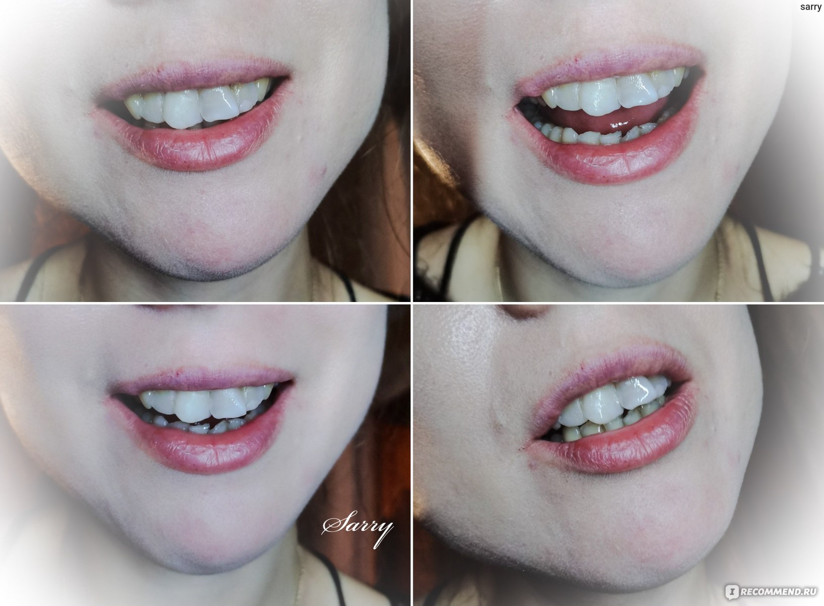 Виниры Aliexpress set for whitening teeth and upper and lower veneers фото