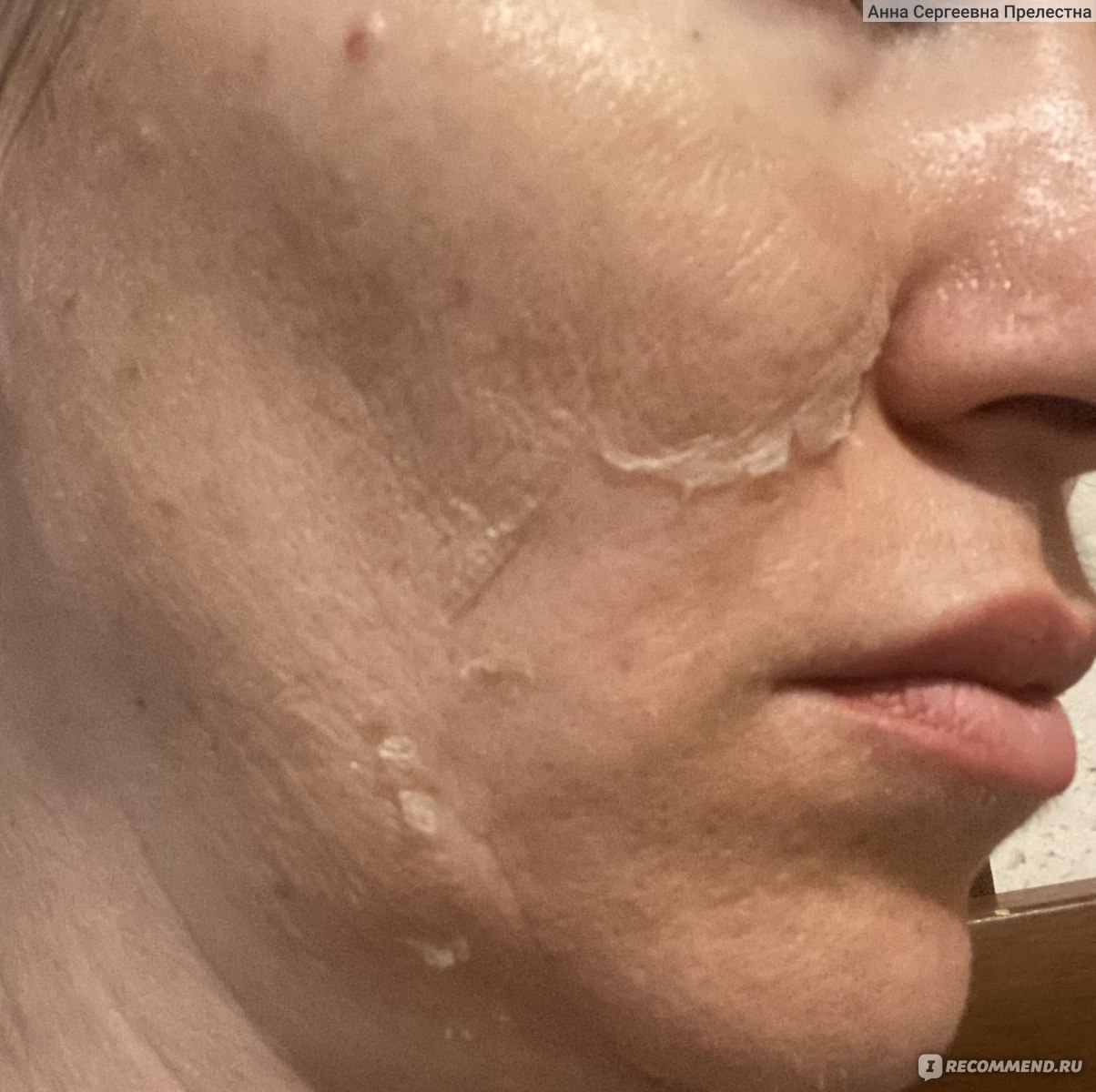 Пилинг для лица GIGI Medic Peel - Derma Лосьон "Дермапил" фото